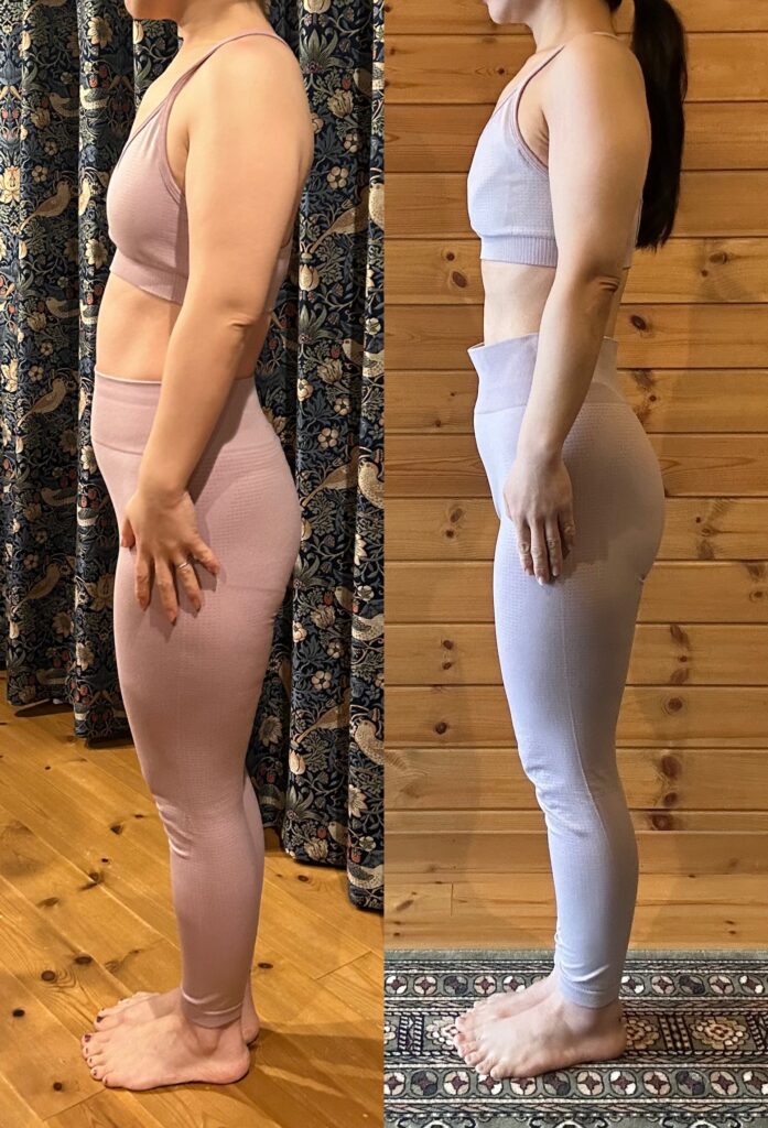 脚やせビフォーアフター